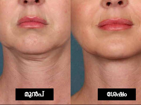 മുഖത്തേക്കാള്‍ സെന്‍സിറ്റീവ് ആയ ഭാഗം