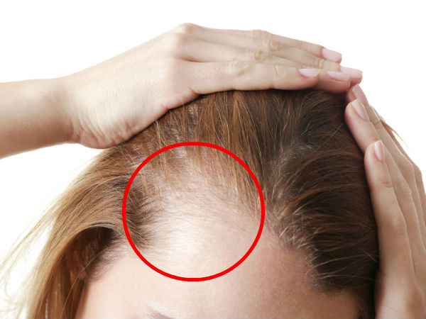 അവോക്കാഡോ ഹെയര്‍ മാസ്‌ക്