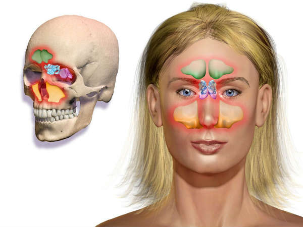  മധുരനാരങ്ങ