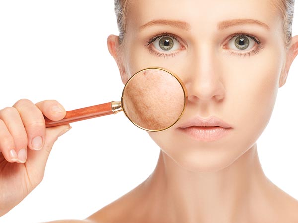 ഗര്‍ഭാവസ്ഥ മെലാസ്മ ചികിത്സിക്കാന്‍ കഴിയുമോ?