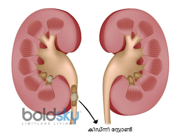 സസ്യങ്ങള് കൂടുതല് ഉള്പ്പെടുത്തുക സസ്യങ്ങള് കൂടുതല് ഉള്പ്പെടുത്തുക