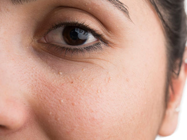  കാരണങ്ങള്‍