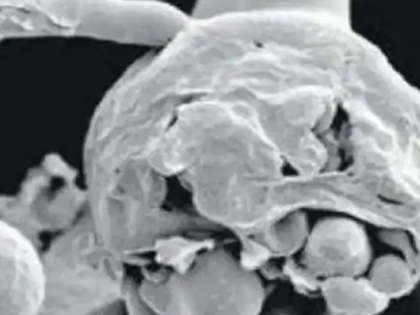 എങ്ങനെയാണ് കണ്ടെത്തിയത് ?