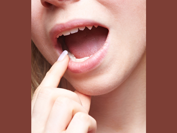 വരണ്ട വായക്ക് കാരണമാകുന്ന മരുന്നുകള്‍