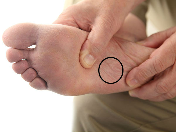 പാദത്തിലെ ചുളിവുകള്‍