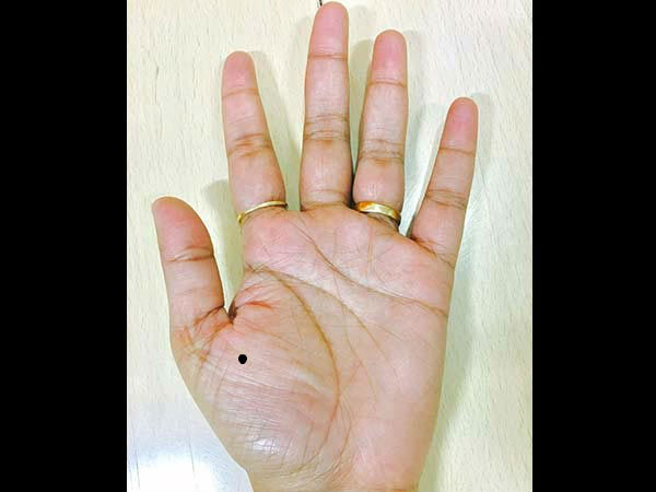 തള്ളവിരലില്‍ മറുക്