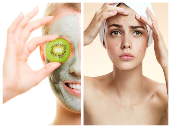 കിവി സ്‌ക്രബ്