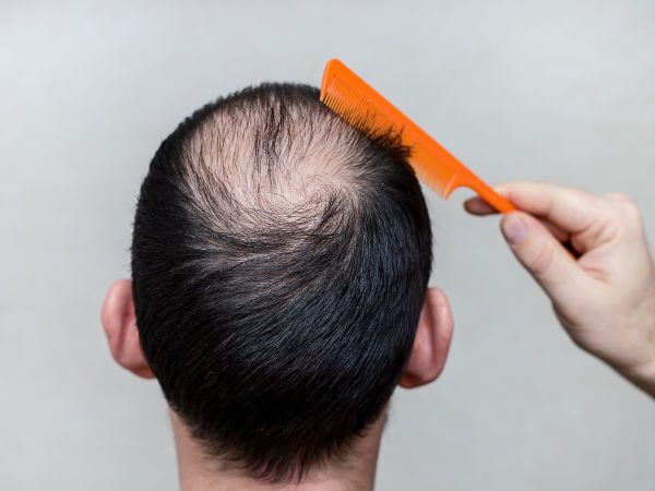 Never Use These Oils On Your Hair Never Use These Oils On Your Hair