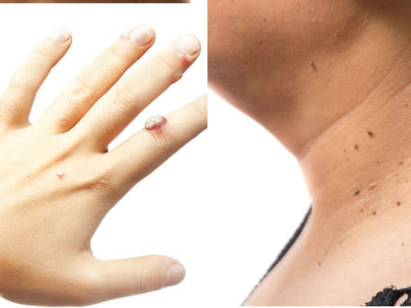 ചര്മ്മത്തെ മോയ്സ്ചറൈസ് ചെയ്യുക ചര്മ്മത്തെ മോയ്സ്ചറൈസ് ചെയ്യുക