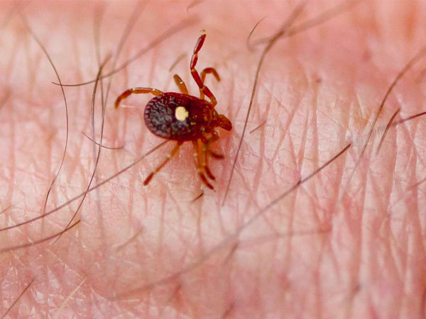 എന്തൊക്കെയാണ് ആവശ്യമുള്ള വസ്തുക്കള്‍