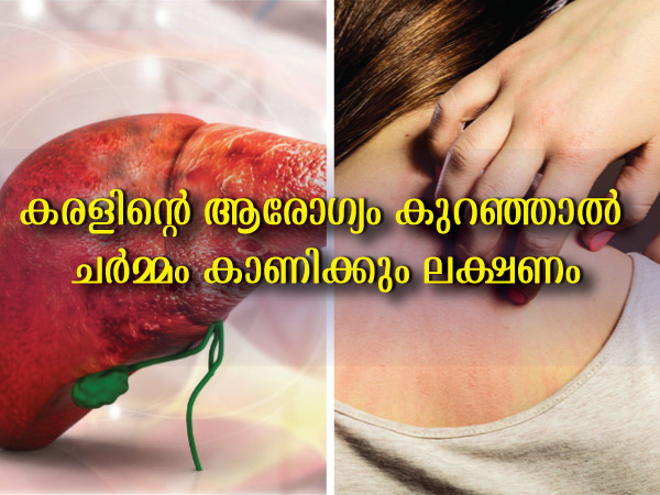 Signs of Liver Damage On Your Skin Signs of Liver Damage On Your Skin