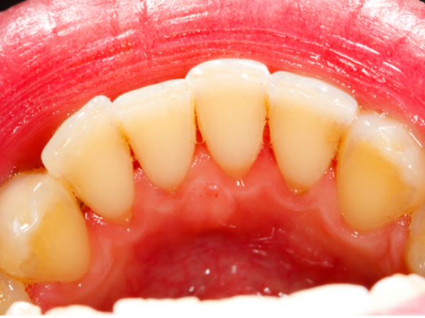 കാല്‍ക്കുലസ്