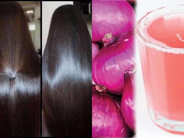 ഉള്ളി മുടിക്ക് നല്ലതാണോ?