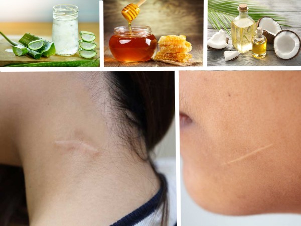 Fade Scars On Face Fade Scars On Face