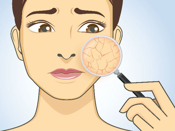 വൃക്കരോഗം