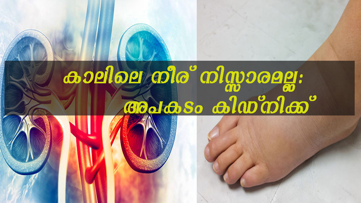 Kidney Failure: Kidney Failure: