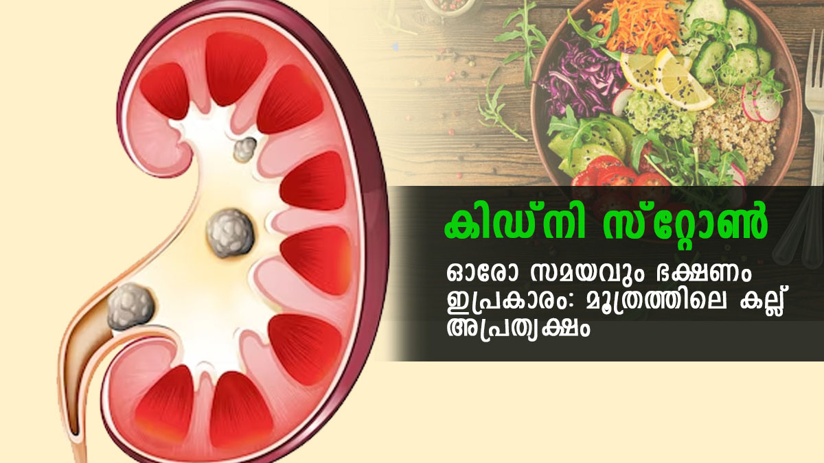 World Kidney Day 2023 World Kidney Day 2023