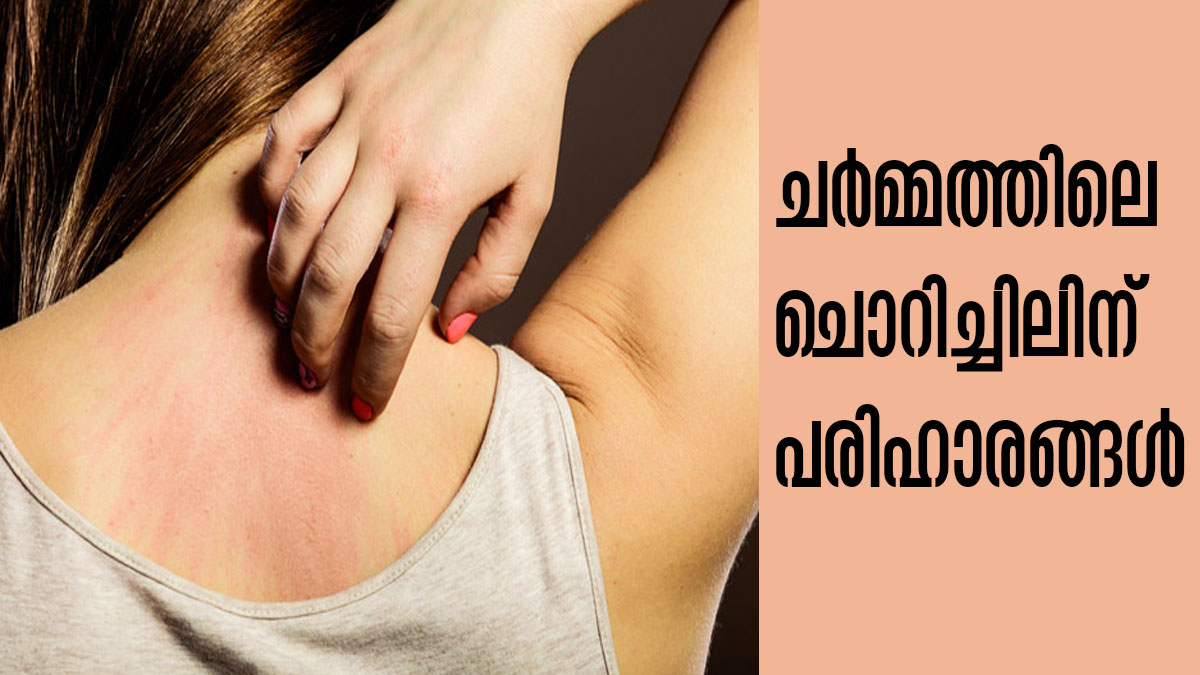 ചര്‍മ്മത്തിലെ ചൊറിച്ചിലിന് എളുപ്പത്തിലാണ് പരിഹാരം, പാര്‍ശ്വഫലങ്ങളില്ല