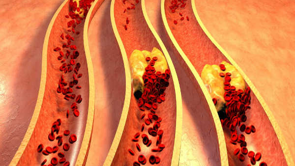 cholesterol effects on body