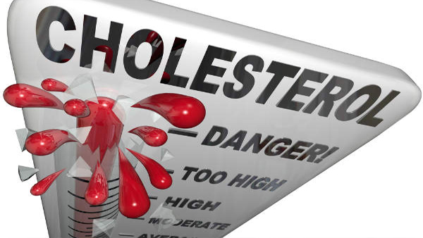 Cholesterol Cholesterol