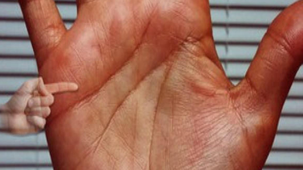 palmistry in malayalam