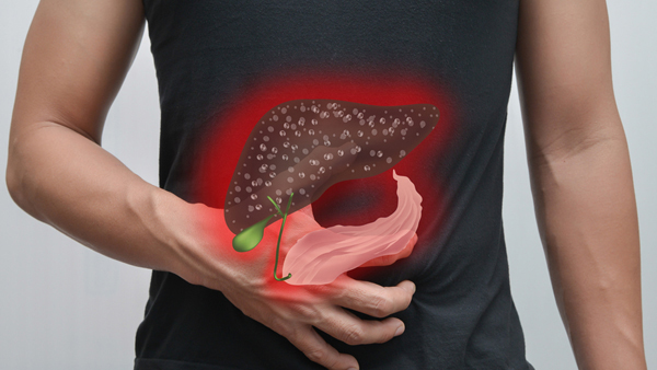 Liver disease in women Liver disease in women