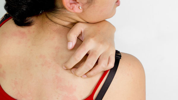 Signs Of Unhealthy Skin