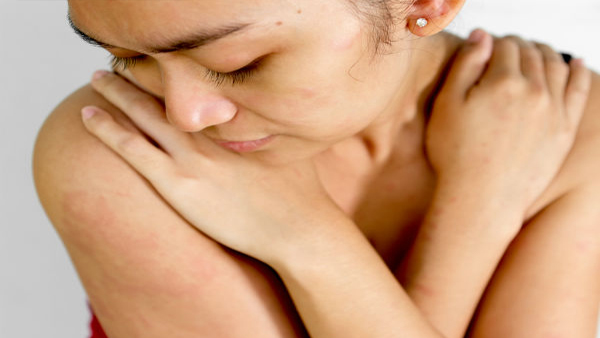 Signs Of Unhealthy Skin