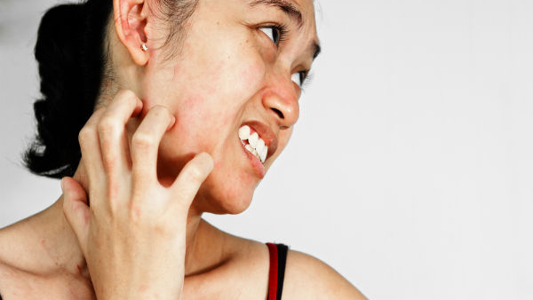 Signs Of Unhealthy Skin