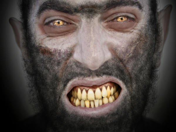 Weird Diseases You Have Probably Never Heard