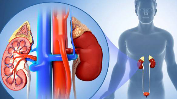 Kidney Disease Sign Kidney Disease Sign
