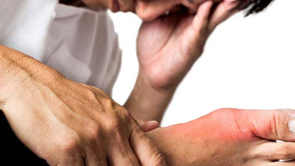 uric acid symptoms uric acid symptoms