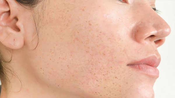 Best Kitchen Ingredients Best Kitchen Ingredients