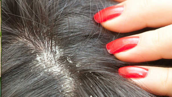 Amla And Lemon Mix Amla And Lemon Mix