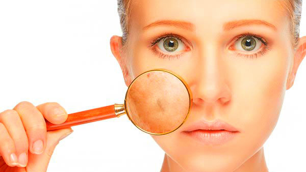 White Facial Patches