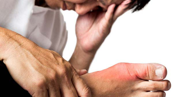 Foods to Reduce Uric Acid Foods to Reduce Uric Acid