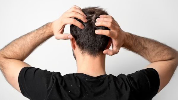 Promote Hair Growth and Prevent Baldness