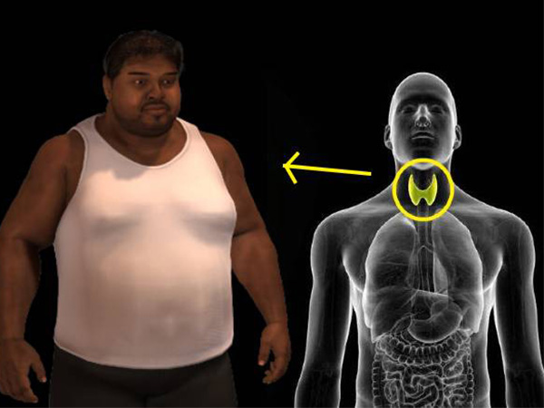 thyroid weight loss thyroid weight loss