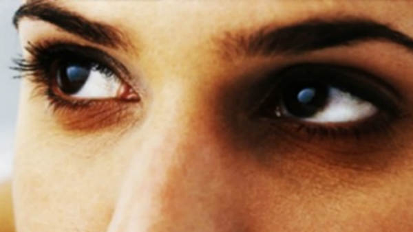 Dark Circles Under Eyes