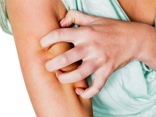 skin infection in monsoon