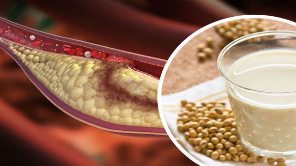 Juice for cholesetrol