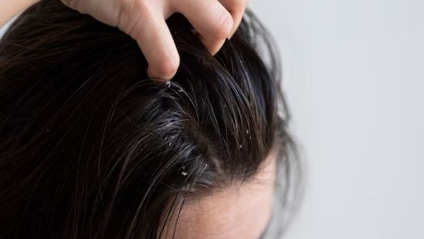 Scalp care secrets