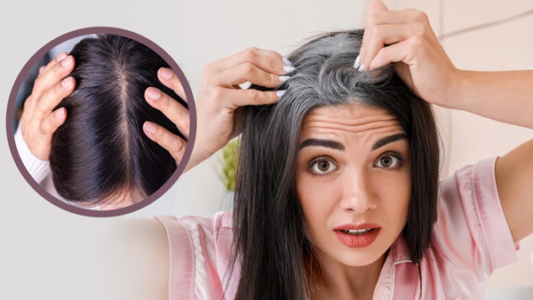 Home Remedies For Itchy Scalp