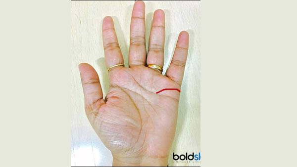 Sun Line In Palmistry
