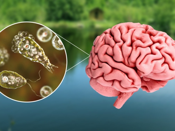 amebic enchephalatis kerala