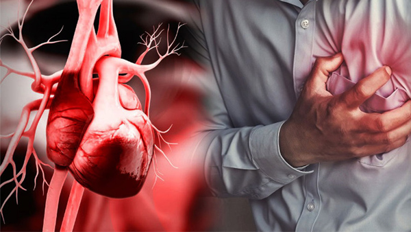 Risk for Heart Attack