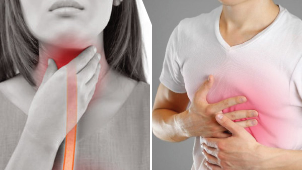 Heartburn or a Heart Attack