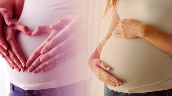 pregnancy discomforts