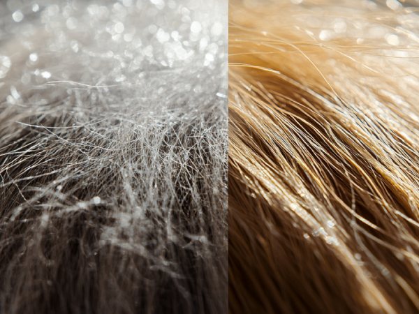 chlorine water damage