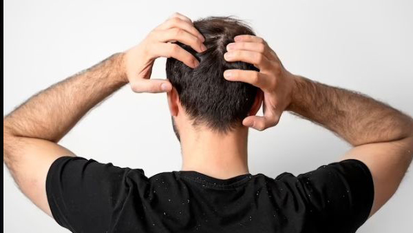 Ayurvedic Remedies for Hair Loss